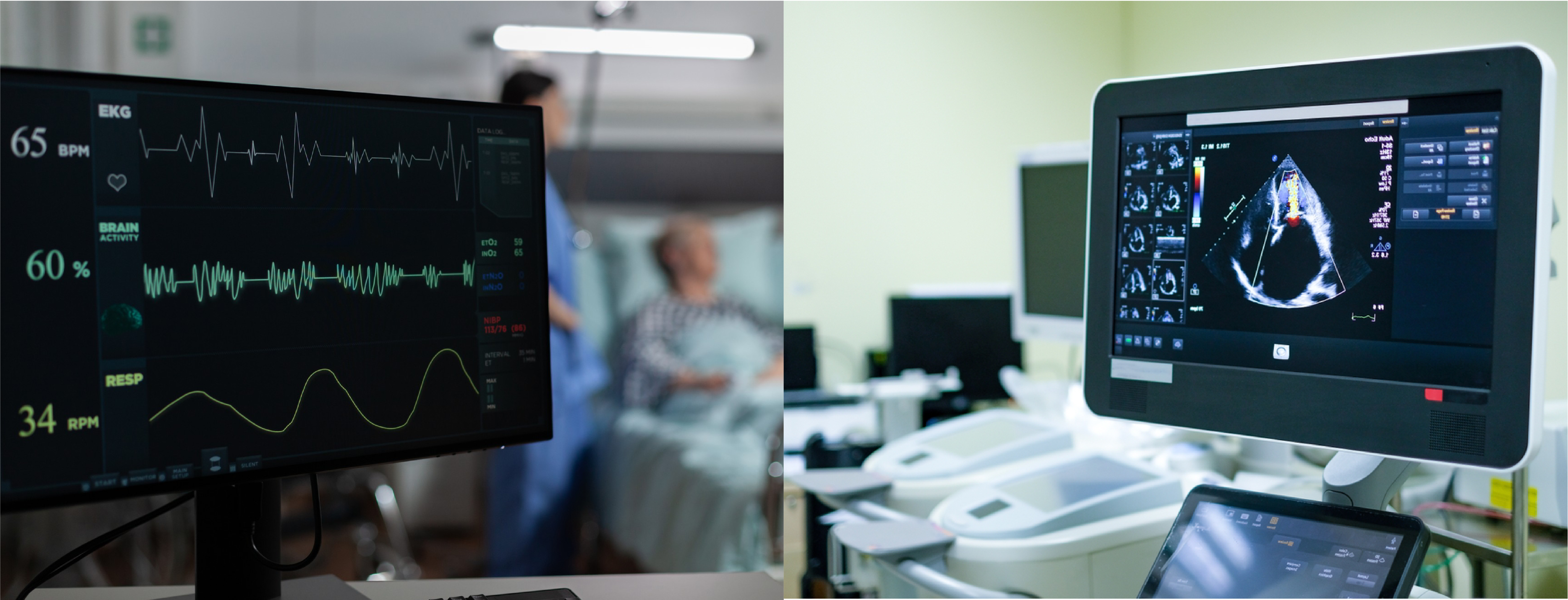 ECG and ECHO Services