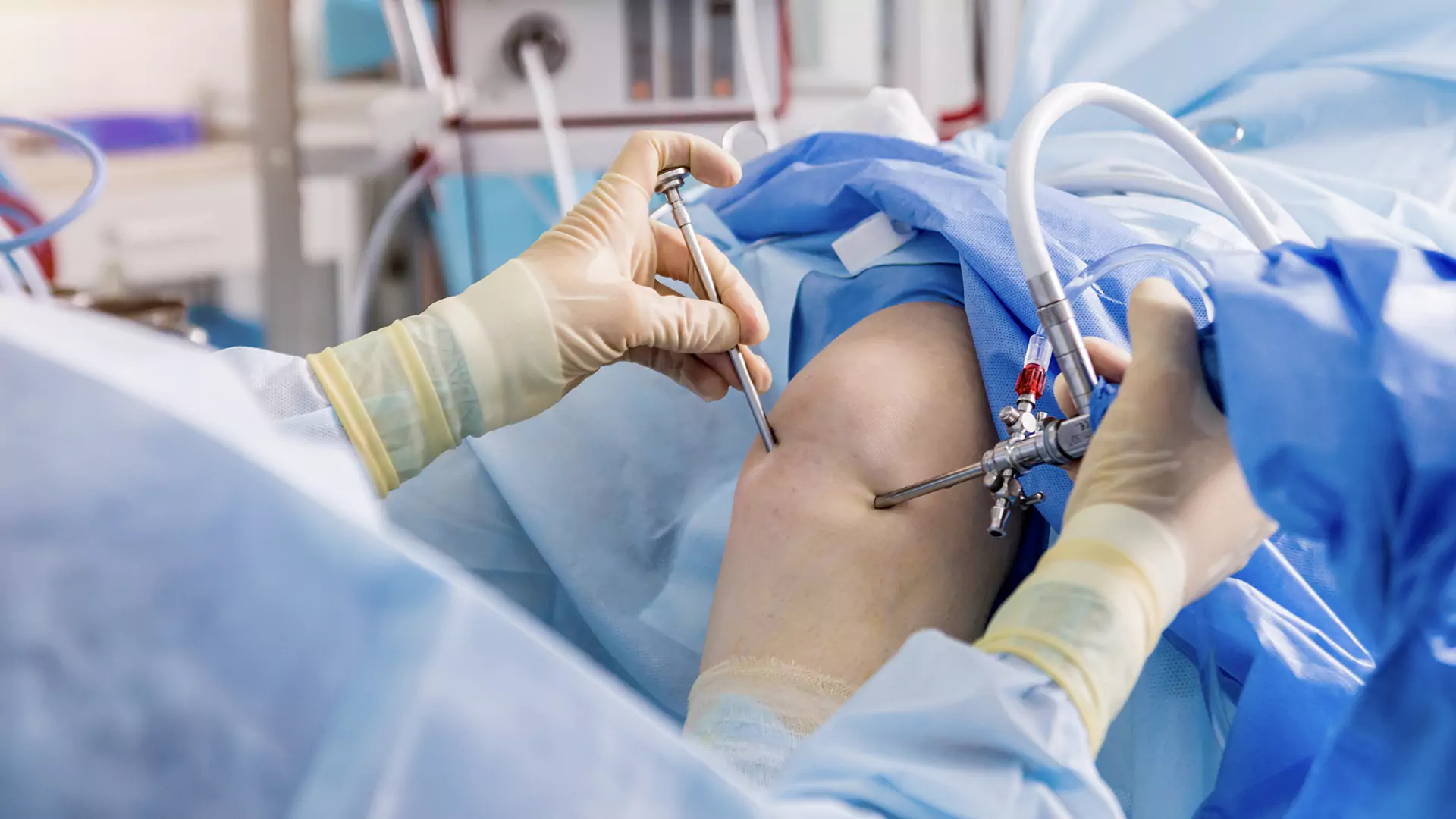 Knee Arthroscopy