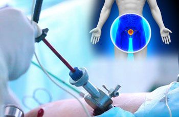 Urology Surgery Care